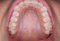 upper teeth from below vantage point